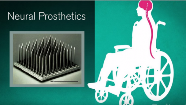 Controlling a Robotic Arm with a Patient's Intentions - See more at: https://www.caltech.edu/news/controlling-robotic-arm-patients-intentions-46786#sthash.BlgDD3au.dpuf