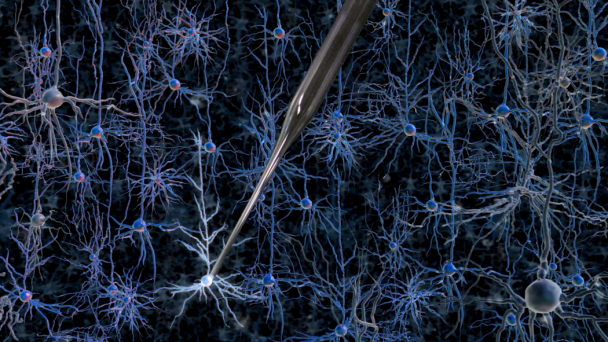 Researchers from Georgia Tech and MIT have automated the process of finding and recording information from neurons in the living brain using a simple robotic system. (Photo: MIT)